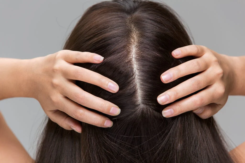 Focus on Scalp Health for Faster Hair Growth